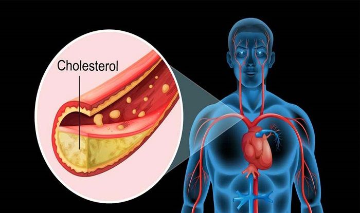 Here Is Why You Must Maintain Balance Between Good And Bad Cholesterol