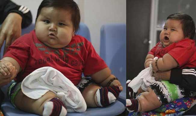 Eight-month-old Santiago Mendoza Colombia’s Most Obese Baby At 20 Kg 