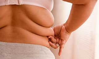 6 Facts about Obesity, a serious health issue in India!