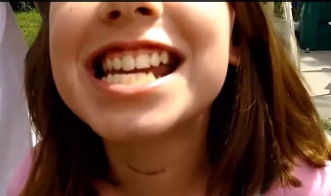 This Girl Pulls Out Her Tooth And The Way She Does It Will Stun You