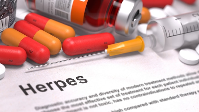 What Percent Of Americans Have Herpes