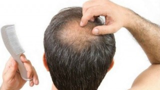 Lifestyle Habits That Are Causing Your Hair Loss Lifestyle Habits That Are Causing Your Hair Loss