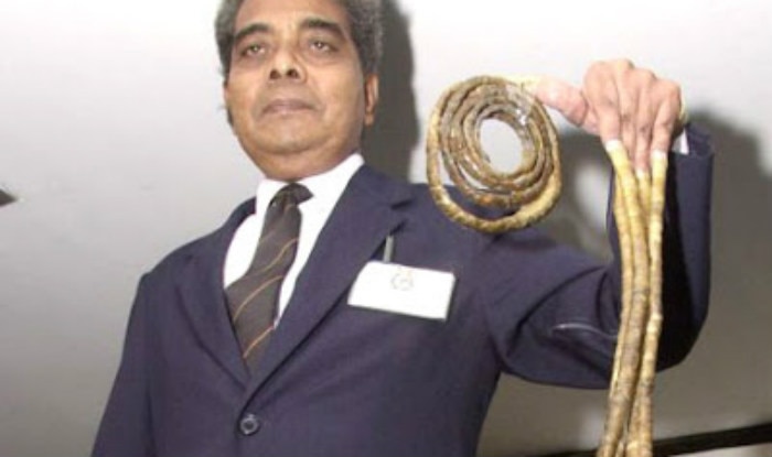 India's Shridhar Chillal sets Guinness World Records for longest  fingernails on one hand! | India.com