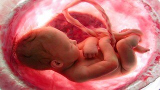 Watch Video: baby dancing in mother womb | अबॉर्शन के लिए गयी माँ के गर्भ में नाच रहा था बच्चा और फिर जो हुआ देखें वीडियो Watch Video: baby dancing in mother womb | अबॉर्शन के लिए गयी माँ के गर्भ में नाच रहा था बच्चा और फिर जो हुआ देखें वीडियो