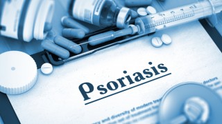 Psoriasis Awareness Month: 7 Vital Facts to Know About the Disease Psoriasis Awareness Month: 7 Vital Facts to Know About the Disease