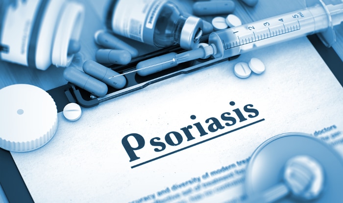 Psoriasis Awareness Month: 7 Vital Facts to Know About the Disease 