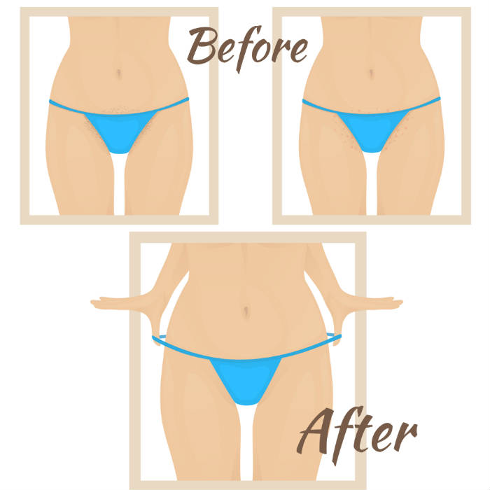 What is bikini waxing: 13 tips to keep in mind before you plan