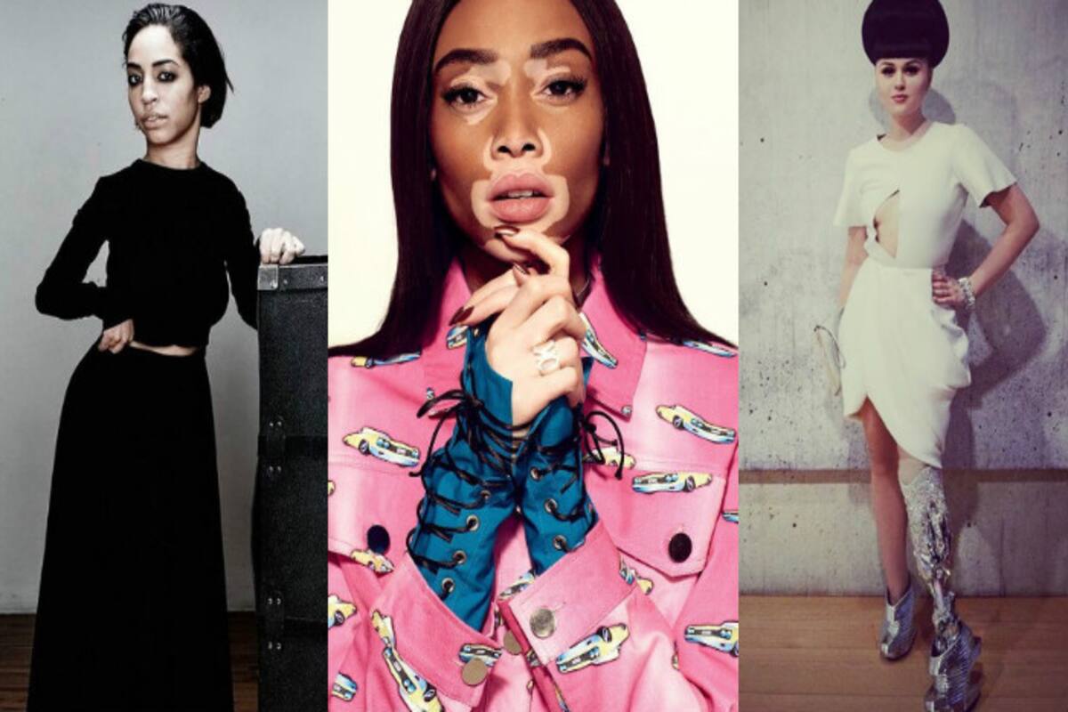 From 'cow' to cover girl, model Winnie Harlow is changing beauty standards
