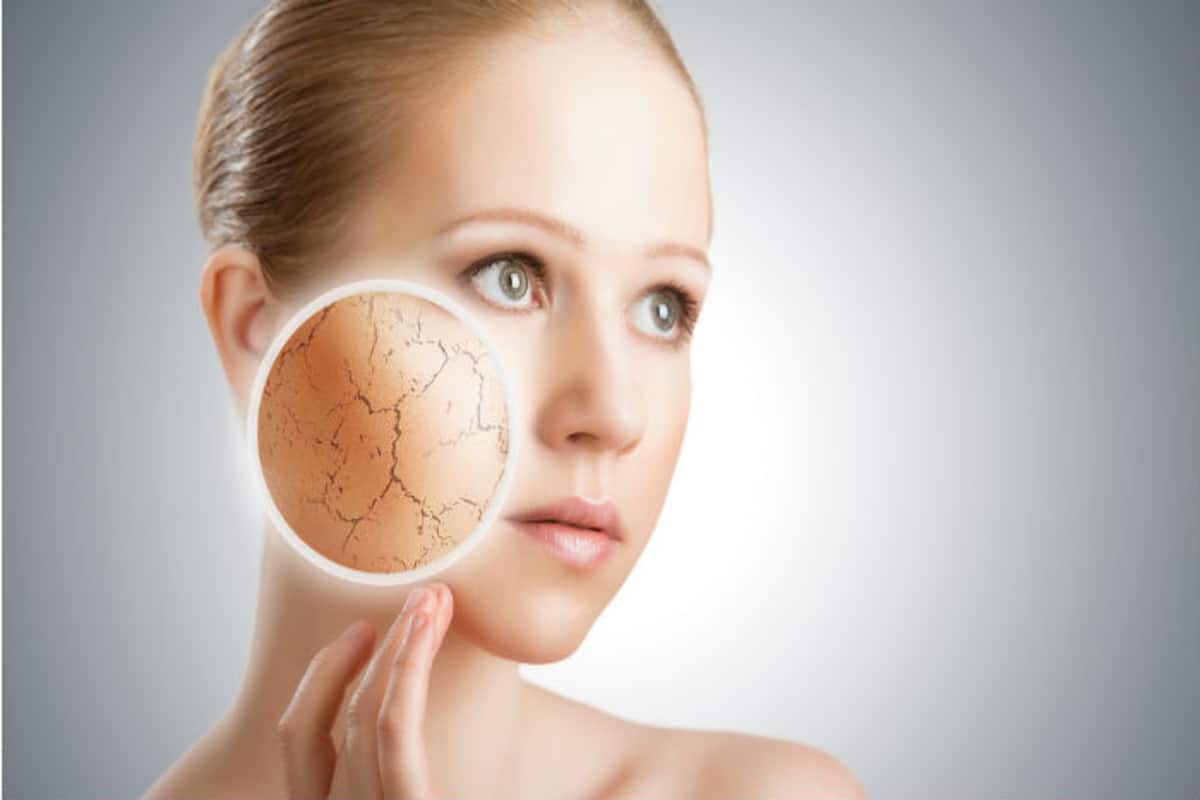 NATURAL DRY-SKIN TIPS AND REMEDIES TO COMBAT DRY FACE 38 Winter skin care tips for dry skin: Best home remedies for dry skin this winter! | India.com