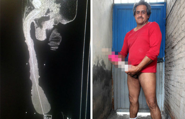 World Record Monster Cock - Roberto Esquivel Cabrera, Man with world's largest penis wants to become a  pornstar! Size does matter â€“ View NSFW pictures | India.com
