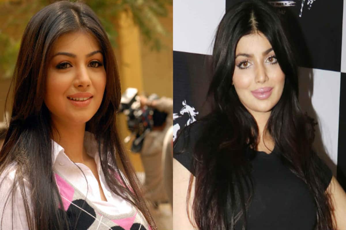 Ayesha Takia, latest victim of plastic surgery gone wrong in Bollywood?  Actress' pictures post lip job keep Twitterati abuzz! 