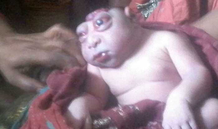 Newborn believed to be Lord Hanuman incarnation in Bihar village, actually  suffers from rare genetic disorder!