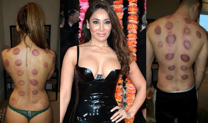 Sofia Hayat strips down to panty with fiance for cupping therapy! Bold  pictures breathe fire on Instagram 