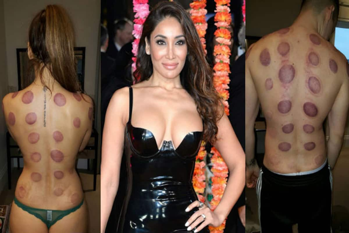 Sofia Hayat strips down to panty with fiance for cupping therapy! Bold  pictures breathe fire on Instagram | India.com