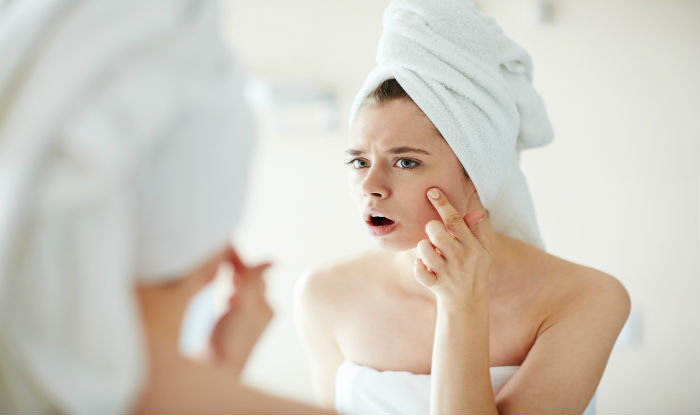 5 Mistakes That Are Giving You Acne Acne