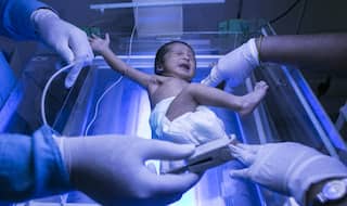 Madhya Pradesh: Girl born with heart outside her chest, admitted in AIIMS hospital Delhi