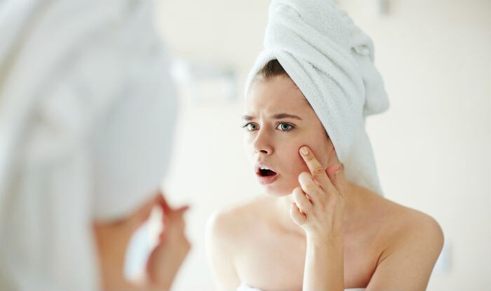 Green tea reduces acne and pimples