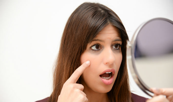 Green tea reduces puffy eyes and dark circles