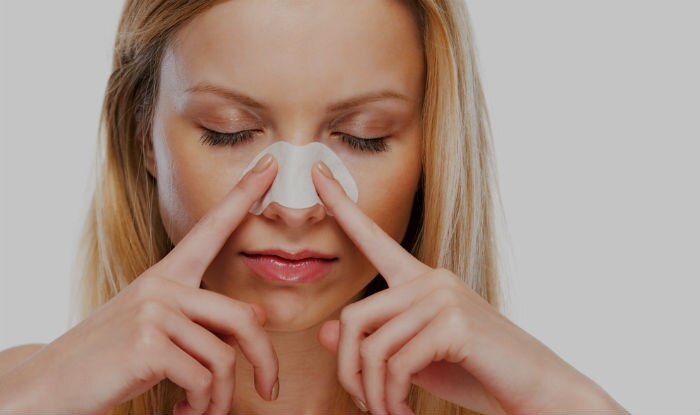 Top 9 frequently asked questions about blackheads, answered!