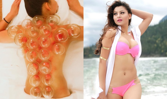 Urvashi Rautela joins the trend of cupping therapy! See picture of hot actress’ bare back cupping session Urvashi Rautela joins the trend of cupping therapy! See picture of hot actress’ bare back cupping session