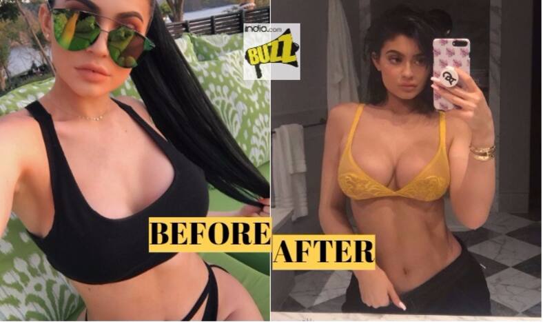 Kylie Jenner Breast Implants Controversy Sexy Model Seductively Poses In Yellow Bra Gets 