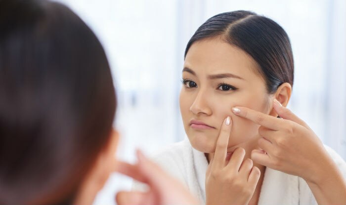 Dry up pimples