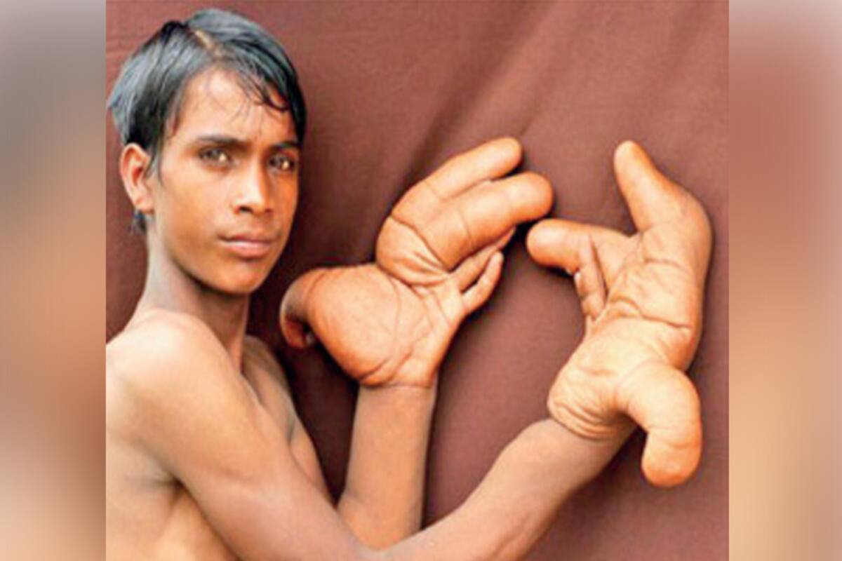 Man With Big Hands Goes Viral