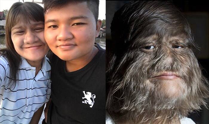 World s Hairiest Girl Shaves For The First Time And Gets Married To Her world-s-hairiest-girl-shaves-for-the-first-time-and-gets-married-to-her