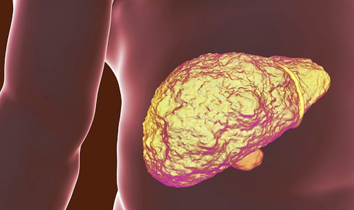 World Liver Day 2021: Tips For Cleansing And Maintaining Healthy Liver