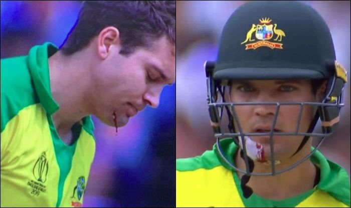 Alex Carey Gets Injured by Jofra Archer Bouncer During ICC Cricket World Cup 2019 2nd Semi-Final Between England-Australia | WATCH VIDEO