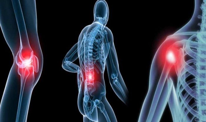 Can Arthritis Affect Young People? Can Arthritis Affect Young People?