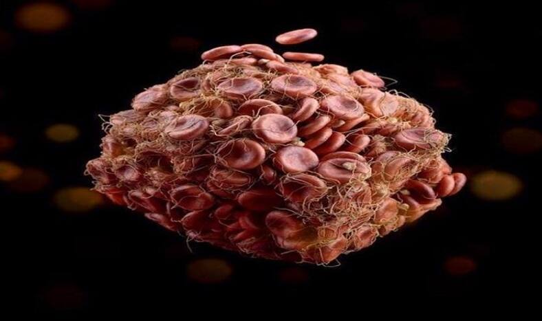 Smoking Hookah Can Form Blood Clot And Cause a Heart Attack