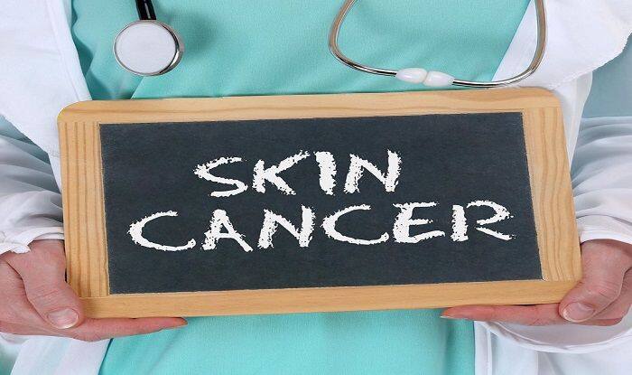 Skin Cancer: Know The Types And Preventive Measures