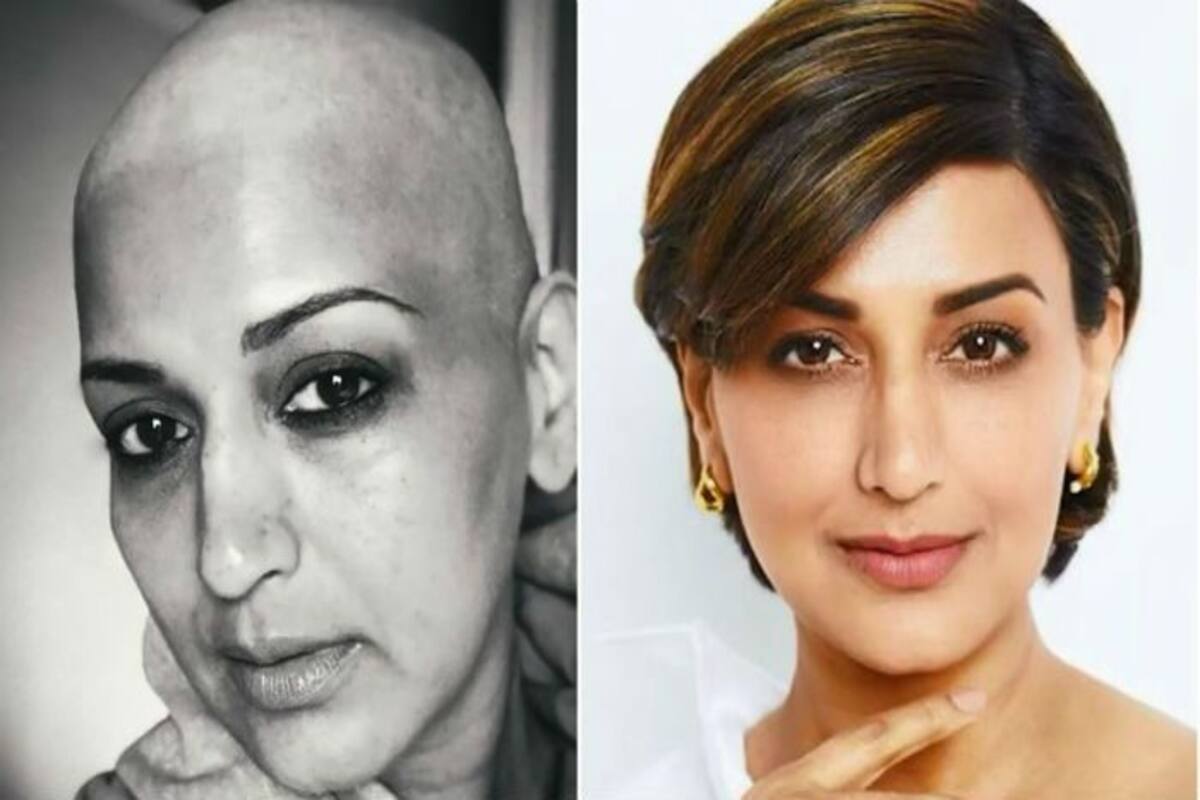 Sonali Bendre Video Sex - Sonali Bendre Shares Powerful Message For All of us on World Cancer Day â€“ A  Note to Self | India.com