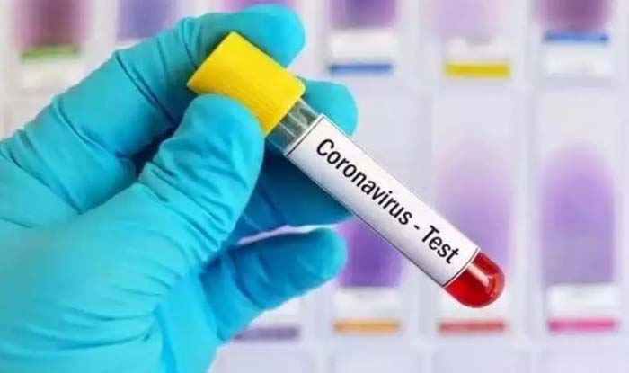 How to Read Covid Test Report What is CT Value