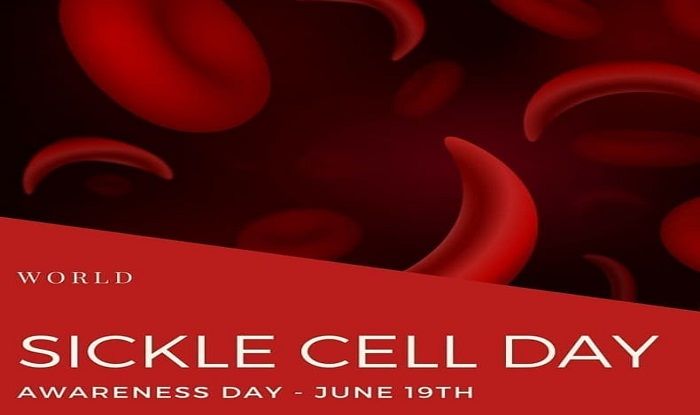 World Sickle Cell Awareness Day 2020: Beware of These Lifestyle Changes