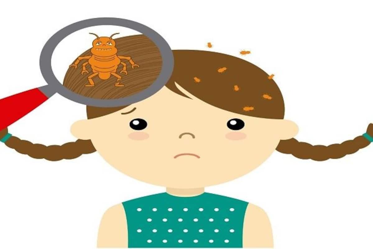 Hair-Care Tips: How to Get Rid of Head Lice Using Olive Oil