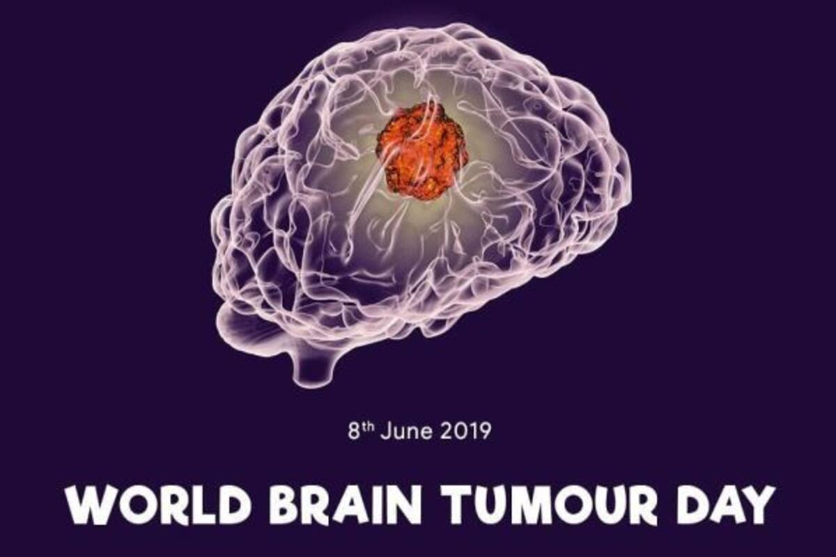 World Brain Tumour Day 2020: Common Myths And Misconceptions Surrounding  Brain Tumour Debunked For You