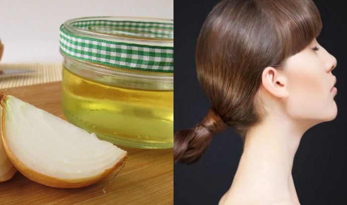 Has anyone had any success using onion juice to regrow their hair? - Quora