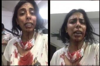 Video of Blood-Soaked NGO Volunteer Goes Viral After Others From 'Neighbourhood Woof' Brutally Assaulted by Locals in Delhi Video of Blood-Soaked NGO Volunteer Goes Viral After Others From 'Neighbourhood Woof' Brutally Assaulted by Locals in Delhi