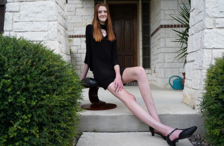Standing Tall At 6 Feet 10 Inches Us Girl Secures Guinness World Record For Longest Female Legs