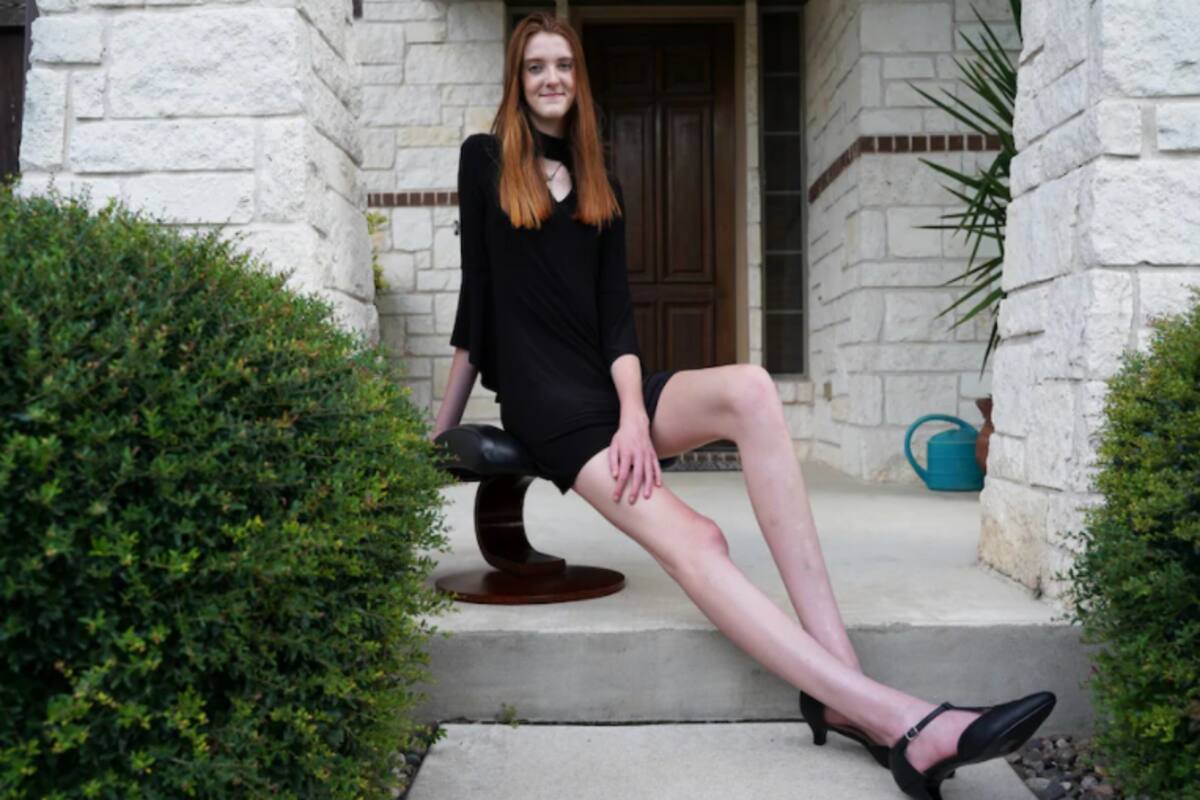Standing Tall at 6 Feet 10 Inches: US Girl Secures Guinness World Record  For Longest Female Legs, See Pics