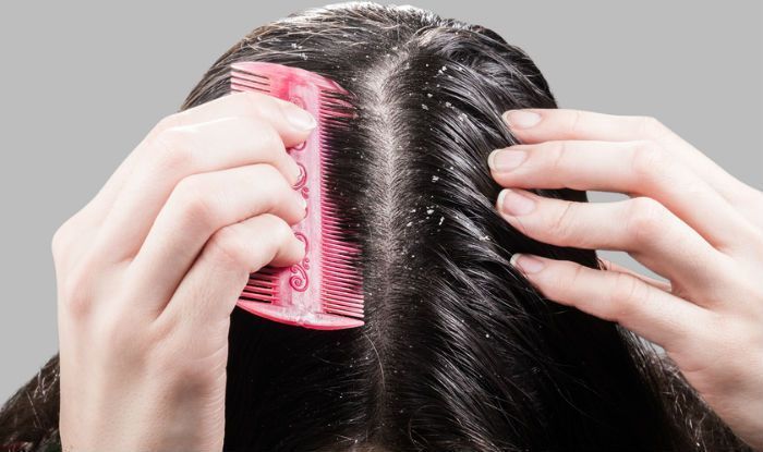 how to solve the hair fall problem and dandruff