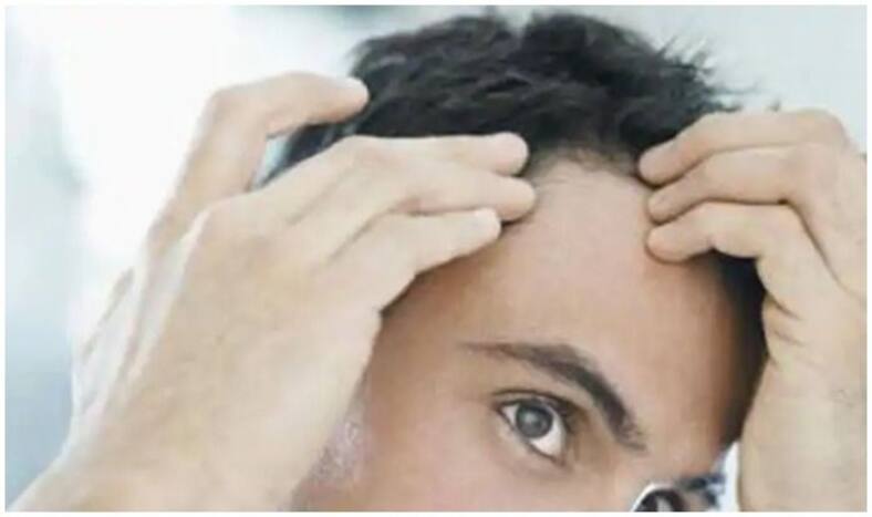 Baldness Home Remedies hair loss treatment causes protection Regrowing hair on a bald spot