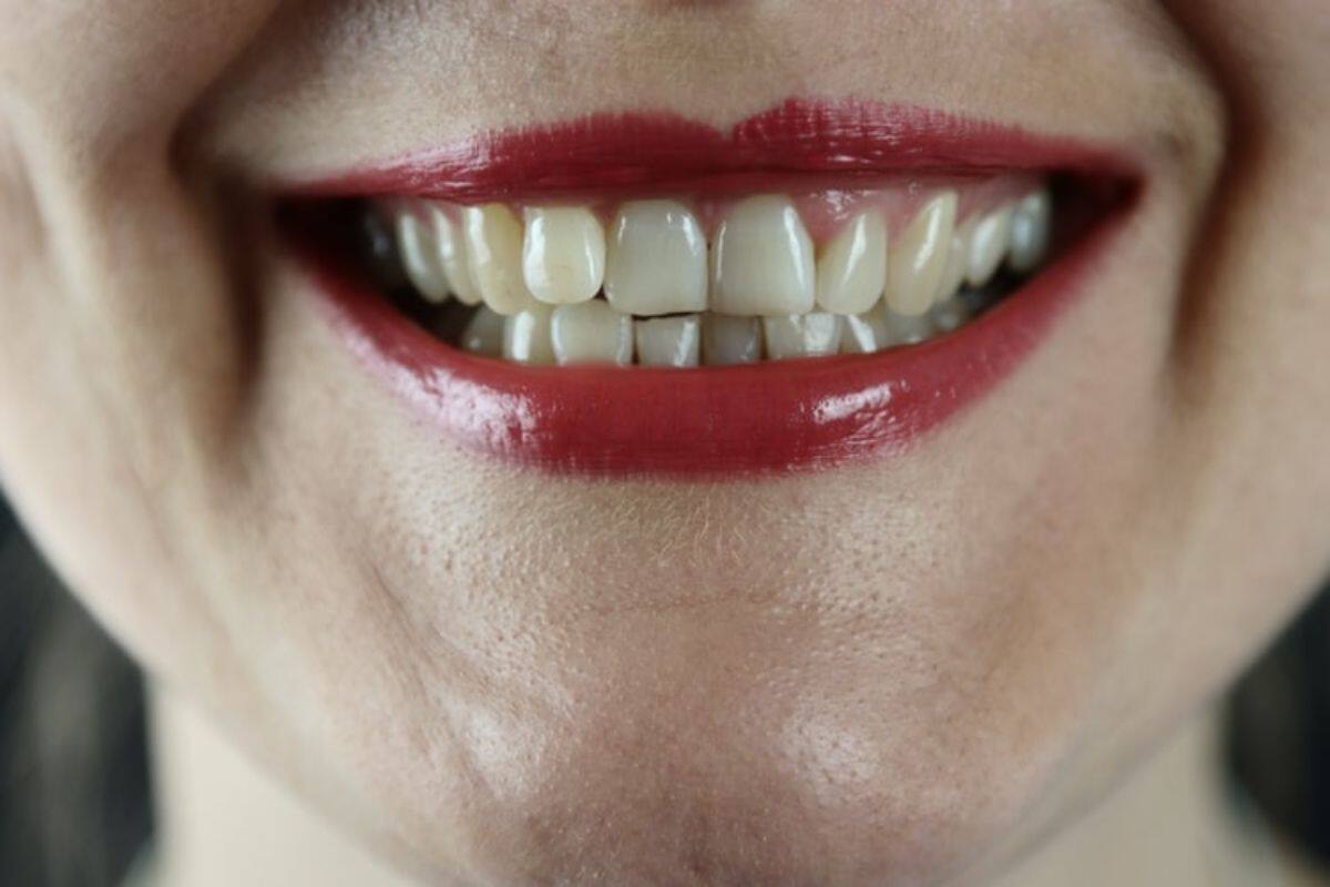 Upper Lip Hair Problem? 5 Easy And Quick Ways To Get Rid of Unwanted Hair at Home Upper Lip Hair Problem? 5 Easy And Quick Ways To Get Rid of Unwanted Hair at Home