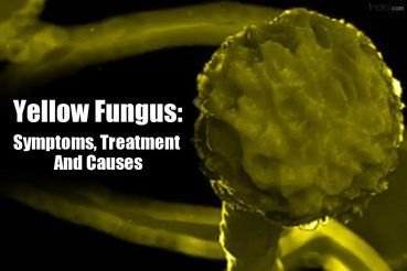 Symptoms Prevention And Causes Of Yellow Fungus Black Fungus And White Fungus Aiims Chief Explains