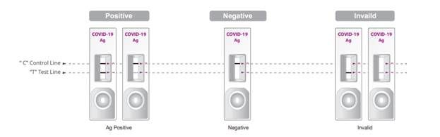 COVID19 Home Testing Kit: Preparations, Method, Test Result And More | All You Need to Know