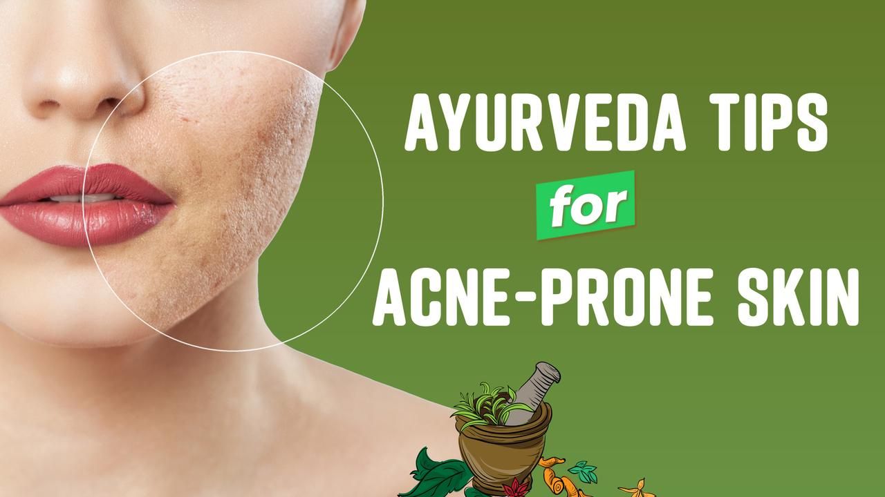 Got AcneProne Skin? Ayurveda Remedies Explained Dr. Sailee Modi