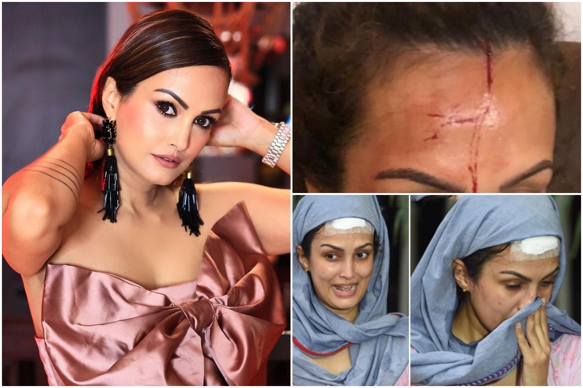 Nisha Rawal Friend Shares Her Disturbing Pictures With Blood-Soaked Face,  Calls Karan Mehra a Demon