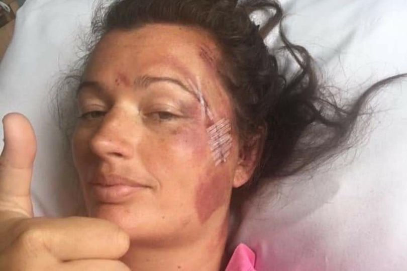 Miraculous: Woman Falls 60-Feet Off Cliff Edge Onto Rocks & Still Survives, Doctors Amazed